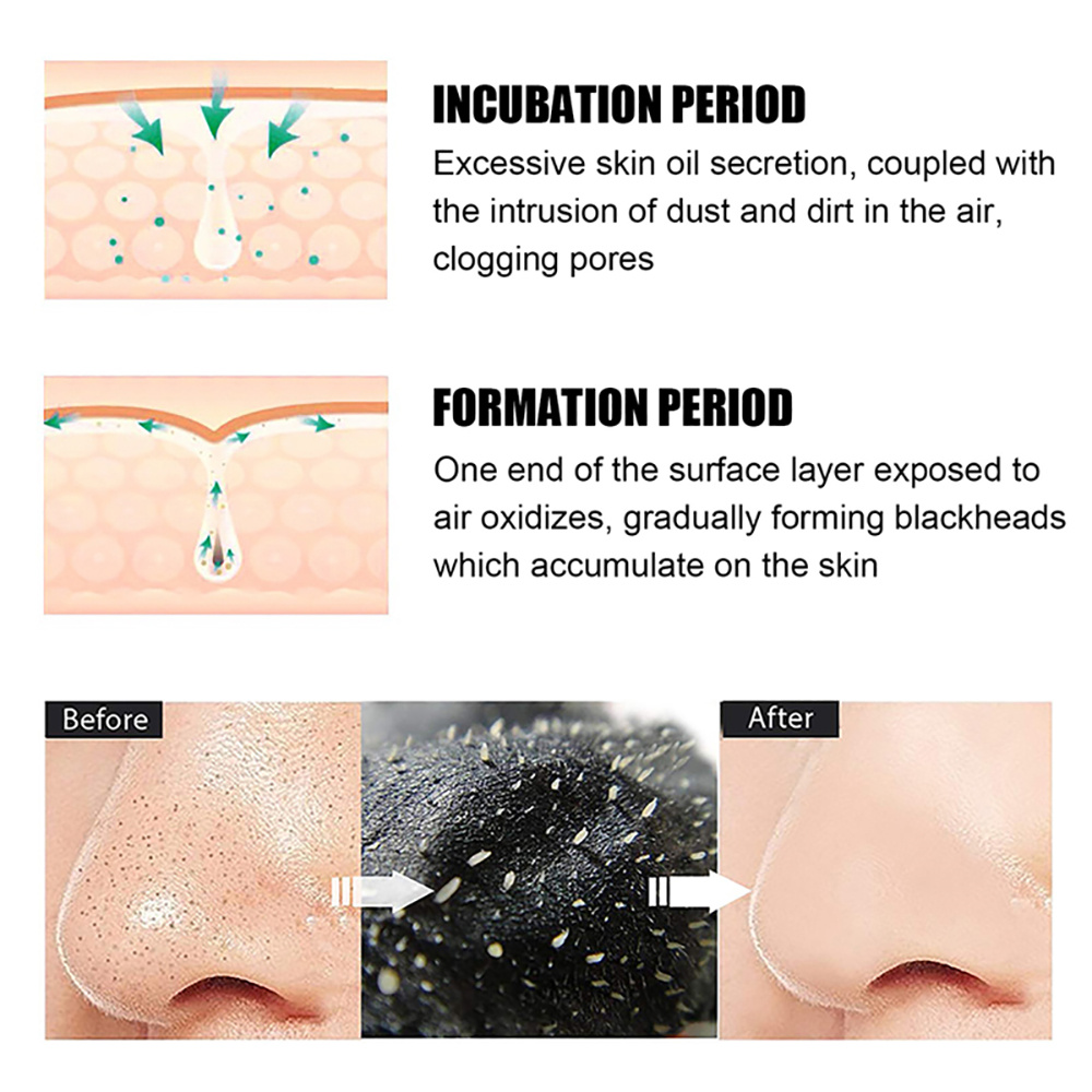 10-100 قطعة قناع إزالة الرؤوس  - مراجعة Nasal Aspirator وسعره
